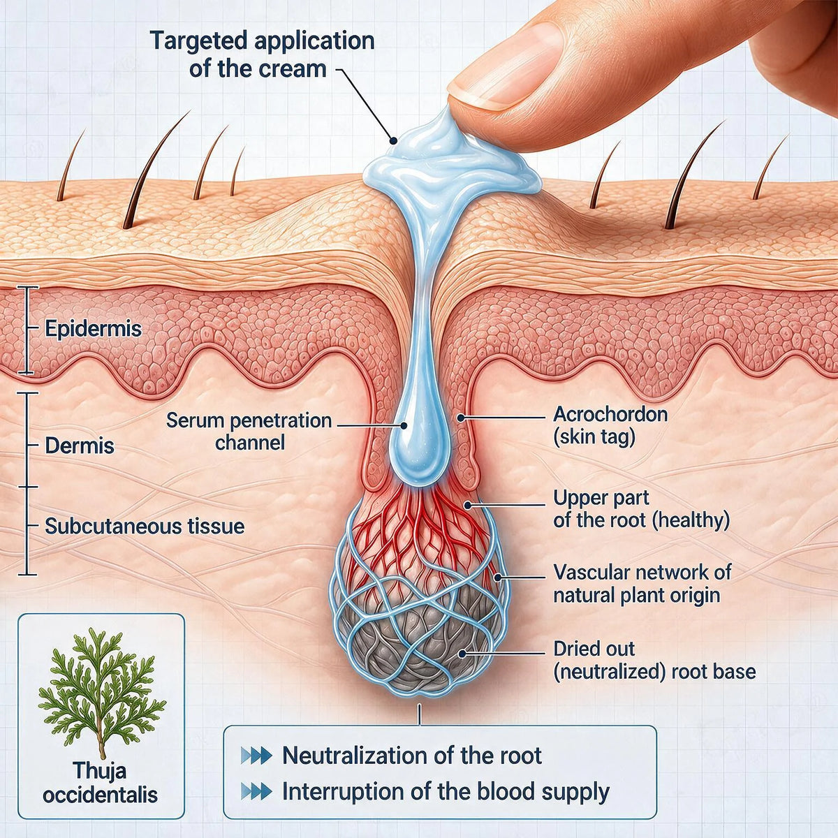 7-𝐃𝐚𝐲 𝐒𝐤𝐢𝐧 𝐓𝐚𝐠 & 𝐒𝐩𝐨𝐭 𝐄𝐫𝐚𝐬𝐞𝐫 𝐂𝐫𝐞𝐚𝐦 (Zero Pain, Zero 𝐒𝐜𝐚𝐫𝐬 Formula)