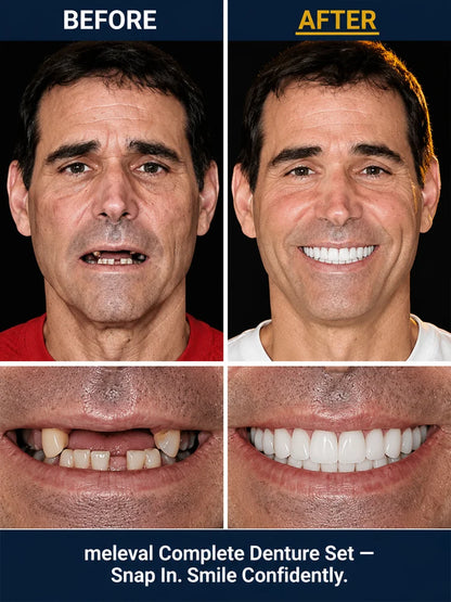 🦷 Premium Complete Denture Set