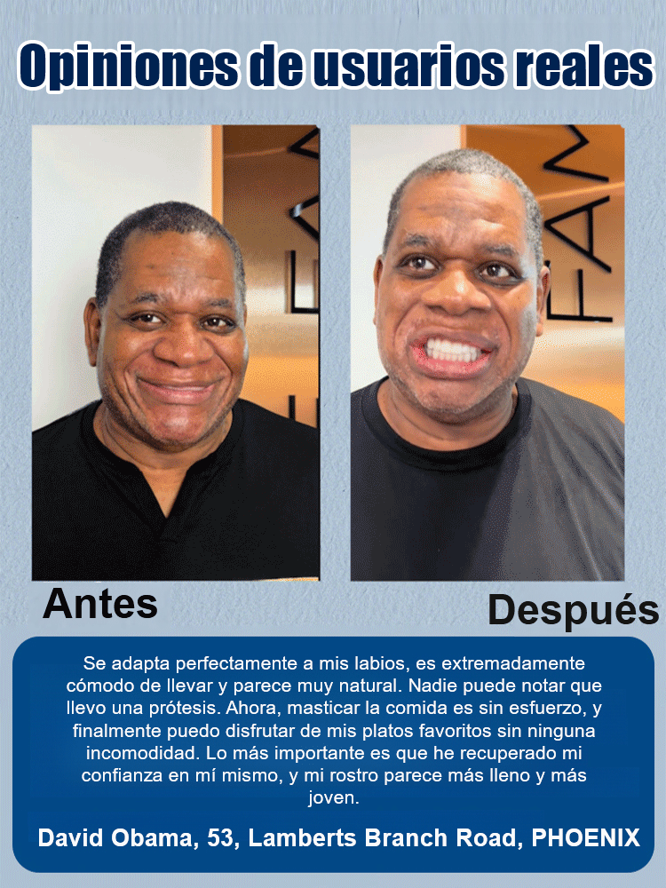 DIYCOS Dentaduras postizas para maquillaje de escenario