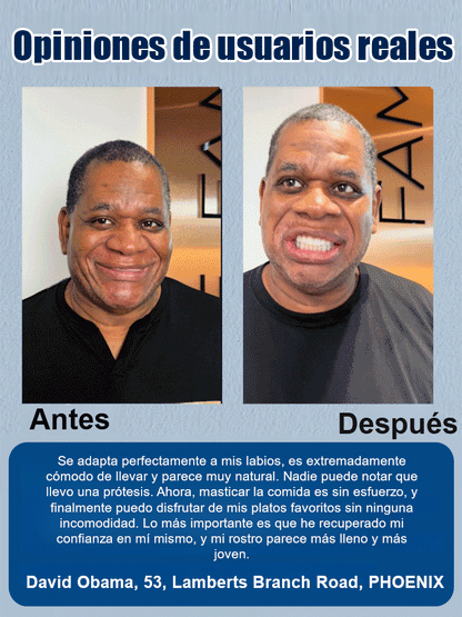 DIYCOS Dentaduras postizas para maquillaje de escenario
