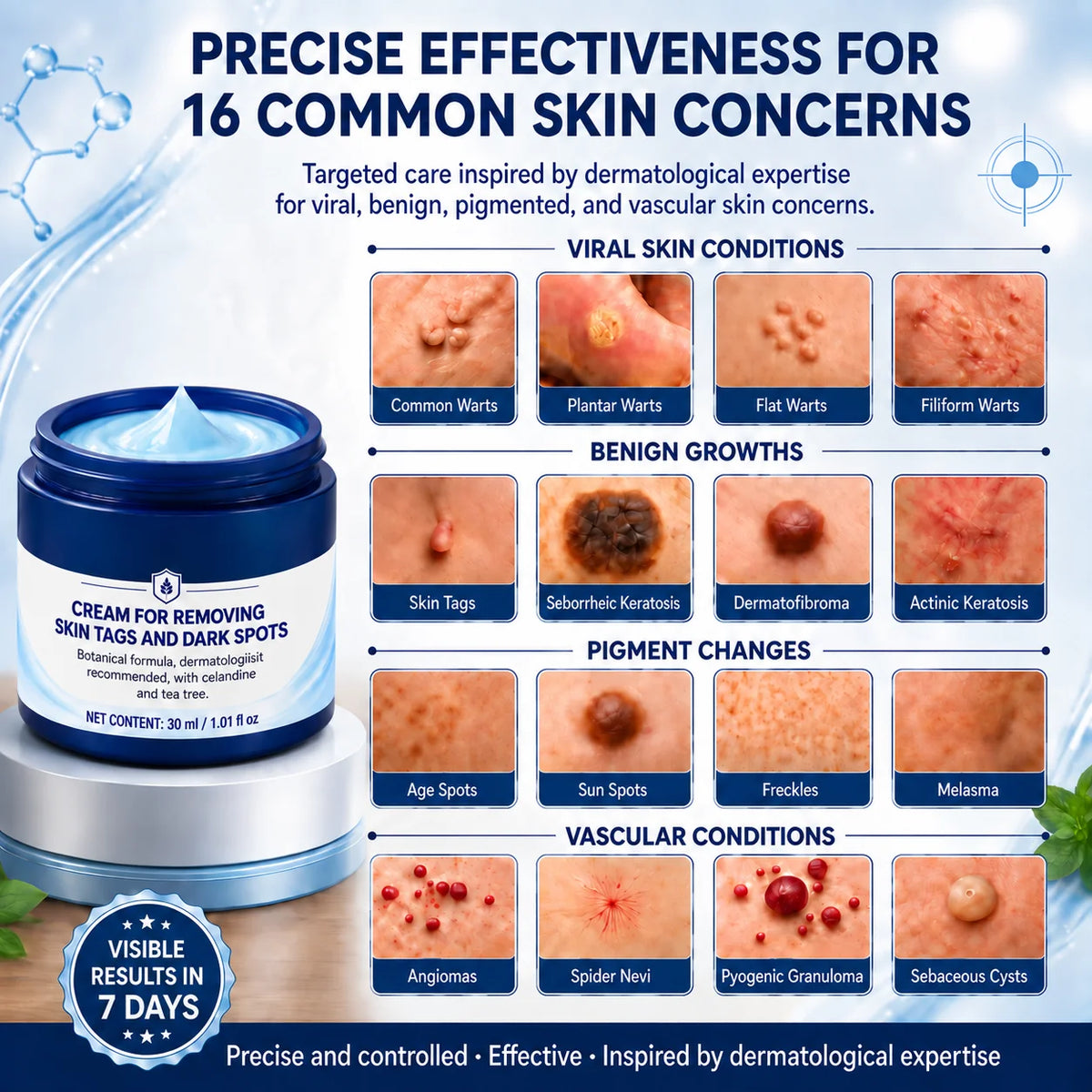 7-𝐃𝐚𝐲 𝐒𝐤𝐢𝐧 𝐓𝐚𝐠 & 𝐒𝐩𝐨𝐭 𝐄𝐫𝐚𝐬𝐞𝐫 𝐂𝐫𝐞𝐚𝐦 (Zero Pain, Zero 𝐒𝐜𝐚𝐫𝐬 Formula)